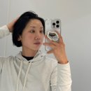 대안크리닝 | 성수동피부과 써니리프팅 두피까지 퀘이사팁 필수인 이유! 10일차 후기