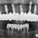 서울하이탑치과의원 이미지