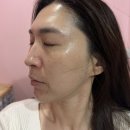 해운대피부관리 장산역에스테틱 피부홀릭 물방울리프팅 후기