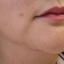 초음한의원 이미지