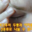 교통사고 후유증 두통과 어지럼증 증상에 따른 치료 이미지