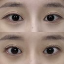 이든뷰티 - 강서구 | 천안 백석동 이든뷰티 속눈썹펌 추천 후기