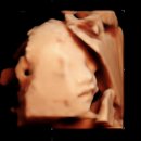 분당-29 | 29주 분당제일여성병원 입체초음파 후기 • 역아가된 아기