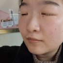 박지인 피부관리 | 신대방삼거리 피부관리 박지인 피부관리에서 윤곽관리 받고 온 후기