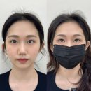 천호대로119길 - 1548 | <건대 눈썹>리터치 자연스럽게 완성! 조이로운 재방문 후기