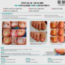 타임네일 페디베네 이미지