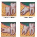 수성사랑니치과의원 이미지