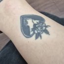 문신지우는 영수쌤 타투제거병원 1회차 후기 (가격/통증)