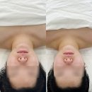 유에보에스테틱 | 대구 윤곽관리 유에보에스테틱 예비신부 후기