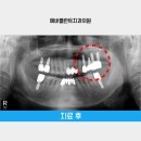 에버플란트치과의원 이미지