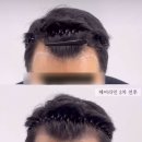 채오름SMP 이미지