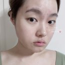 피부 얼굴트러블 개선 여드름 영양제 포아크네 이소틴 내돈내산 1주 후기