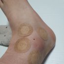 황골마을 인창한의원 이미지