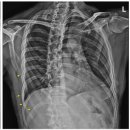 날개병원 이미지