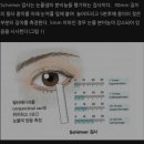 밝은눈안과의원 강남 |스마일라식 검사 후기, 안구건조증 5mm 충격 결과(시력검사부터 각막 두께, 동공...
