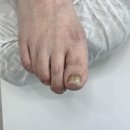 푸스케어서면부전점핑풋 | 서면풋케어는 핑풋 푸스케어 서면부전점으로 다녀오시길!!