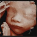 아이제일산부인과의원 이미지