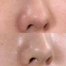 모공줄이는법, 블랙헤드제거부터 코 피지관리까지, 스와니코코 포어 클리어런스 피지제거액 사용 후기