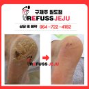 레푸스제주점 | [제주발각질] 미국에서 오신 고객님의 레푸스제주 발각질관리 후기