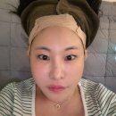 실 - 아산시 번영로217번길 28-3 | 신사피부과 실리프팅후기 , 효과 팽팽해짐