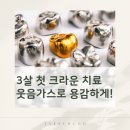 웃음치료의 힘 | 34개월 아이 크라운 치료 후기 ㅣ 어린이 치과 웃음가스 경험까지