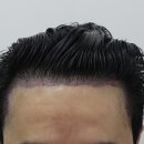 압구정맘모스헤어라인의원 이미지