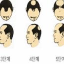 심는가발 이미지