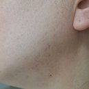 세종탑재활의학과의원 | 세종시 소담동 피부과 전문 병원 추천 BEST 6곳