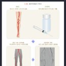 관상동맥질환[Coronary Artery Disease] 이미지