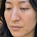 모공화장품 | 모공 화장품 추천 모공 축소 직접 경험한 후기