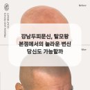 탈모왕 본점 이미지