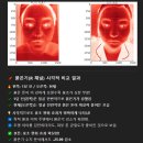 [공지] 집에서 물방울초음파 1달 사용 후기 | 효과 진짜 대박이네