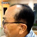 스마트보청기 할인매장 이미지