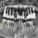 찬스플란트치과의원 이미지