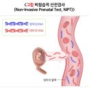 미래적산 | [산전검사] 니프티(NIPT) 검사 │ 12주차에 진행한 비침습적 산전검사 (니프티후기, 염색체검사, 임신기록)