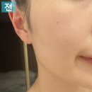 내돈내산 차앤박 CNP 프로폴리스 에너지 액티브 앰플 마스크 후기 차앤박 마스크팩 올리브영추천템