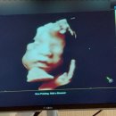 광교은산부인과의원 이미지