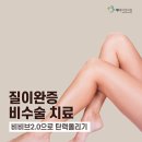 비비블랑 이미지