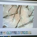 범어역 엘리베이터 앞 | 대구 두피관리 | 헤솔두피클리닉스 범어점 | 재방문 후기