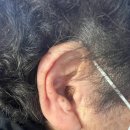 포낙보청기 대구센터 이미지