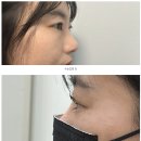 에스파이브C | 송도 속눈썹펌 라부티크, 내 눈매에 맞는 속눈썹 펌 컬 종류