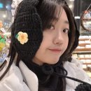 안면 비대칭 교정 시술 후기(1차) 심부볼윤곽주사 및 코조각주사 14일차의 현실적인 리뷰(보정x) | 갸름...
