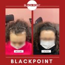 김헤어라인 이미지