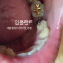 서울힐링치과의원 이미지