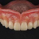 오케이치과기공소 이미지