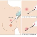 삼성베스트유외과의원 이미지