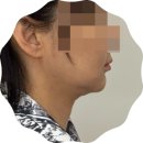 배곧에스테틱 럽인바디핏 신기한 두피리프팅과 데콜테 (건식두피관리인데 얼굴이 리프팅!)
