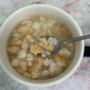 장바로내과의원 | 장바로내과 건강검진 수면 위/대장 내시경 후기 주의사항 생리주기