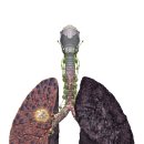 건강한장연합내과의원 | 사상 내과 병원 추천 기침 안낫고 쌕쌕 숨소리 40대 이상 흡연자분들은 이 검사 필요해요