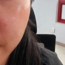 더운여름철 피부모공 리프팅 화장품 찐후기!!